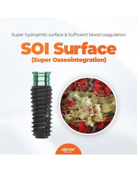 TS Ill SOI implant