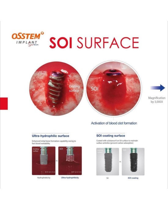 TS Ill SOI implant