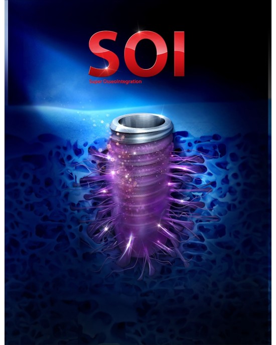 TS Ill SOI implant